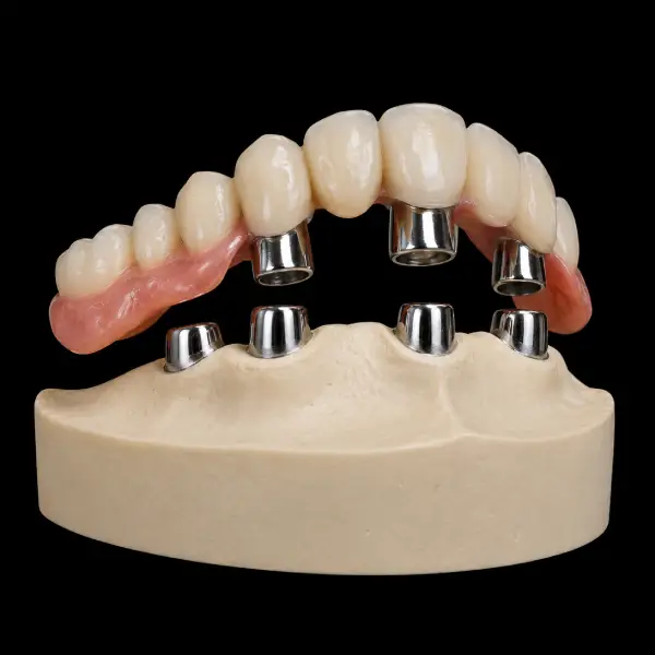 Primary-Secondary Crown Telescopic System