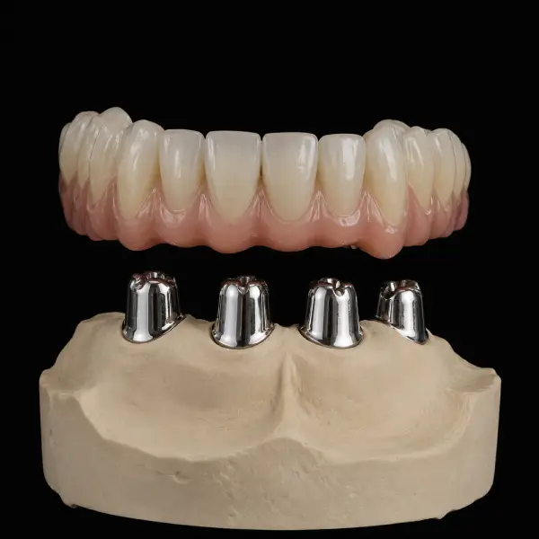 Resilient Cobalt-Chrome Telescopic Crowns
