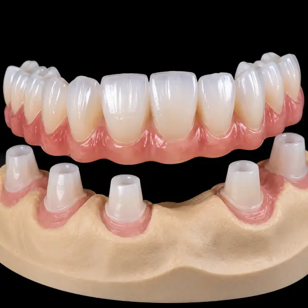 Resilient Zirconia Telescopic Crowns