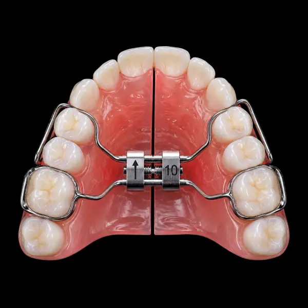Split Plate Expander