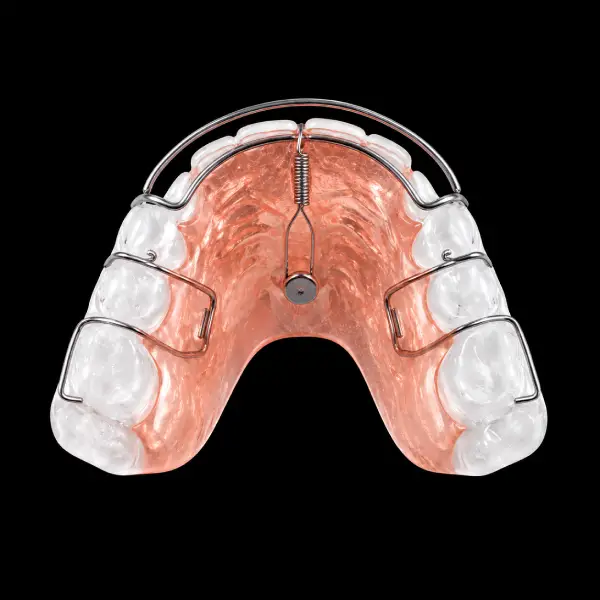 Spring Hawley Retainer