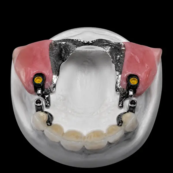 Standard ERA Attachment