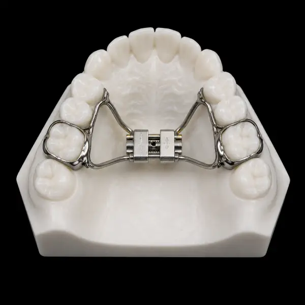 Standard Hyrax Rapid Palatal Expander