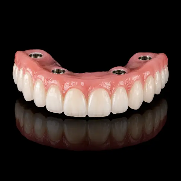 Standard Implant Hybrid Denture