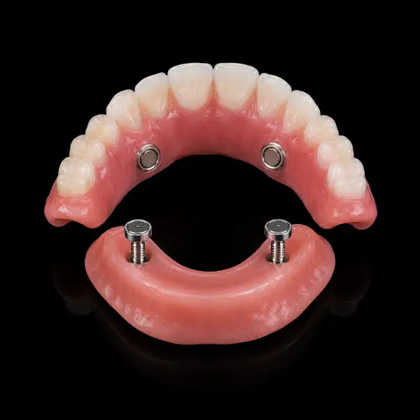 Standard Magnetic Attachment