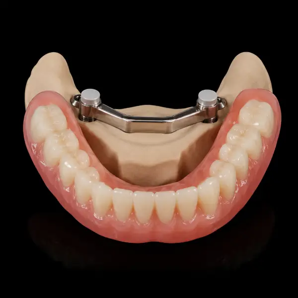 Standard Stud-Snap Attachment