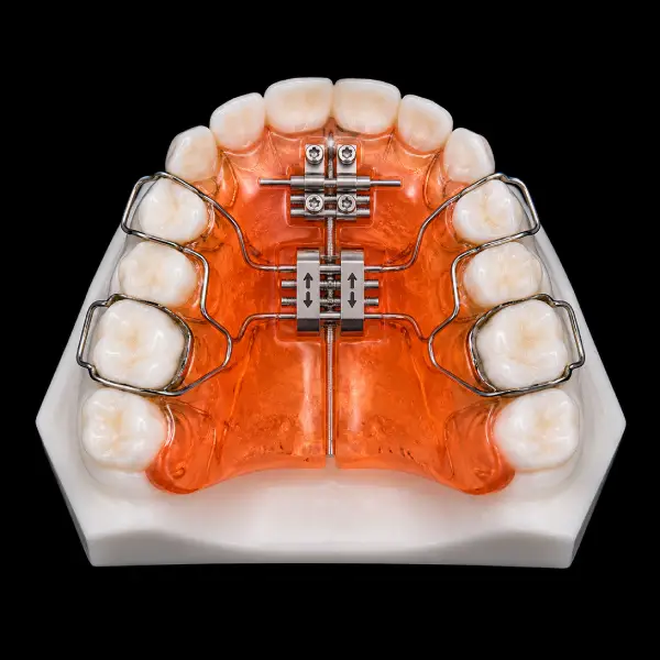 Three-Way Expander