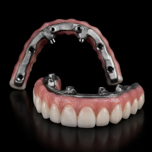 Titanium Bar All-on-46 Hybrid