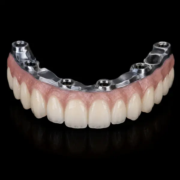 Titanium Hybrid Malo Bridge