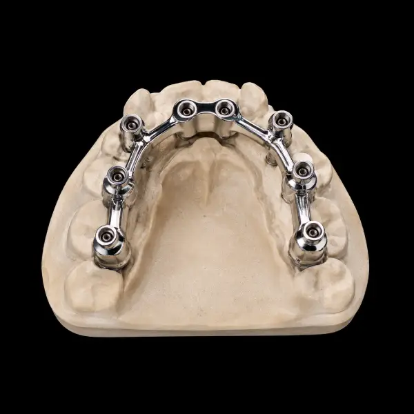 Vitallium Implant Overdenture Bar Framework