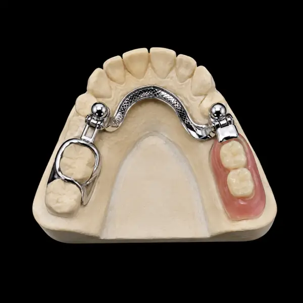 Vitallium Precision Attachment Framework