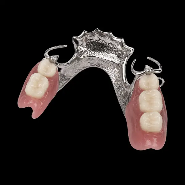 Vitallium Removable Framework with Clasps