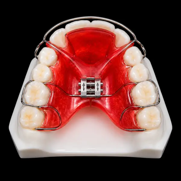 Y-Plate Expander