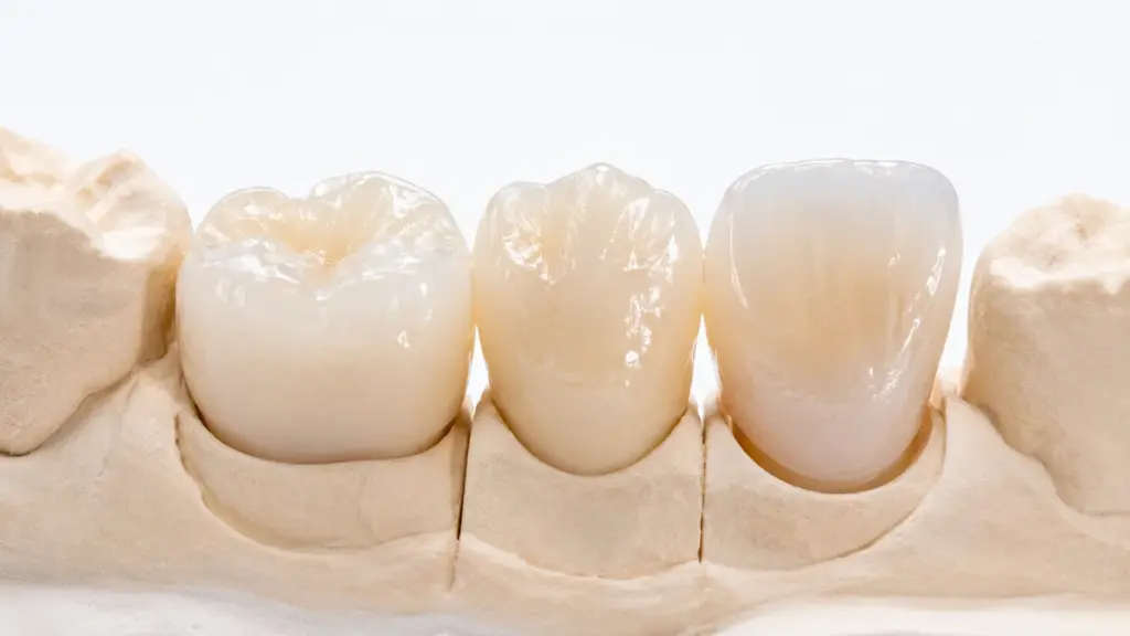 Zirconia Crowns Materials