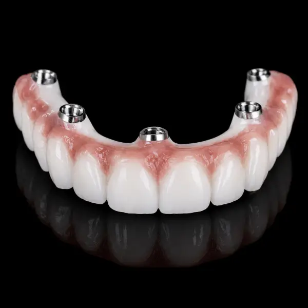 Zirconia Malo Bridge
