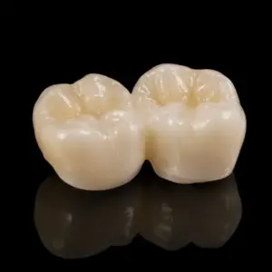Zirconia Overlay Restorations