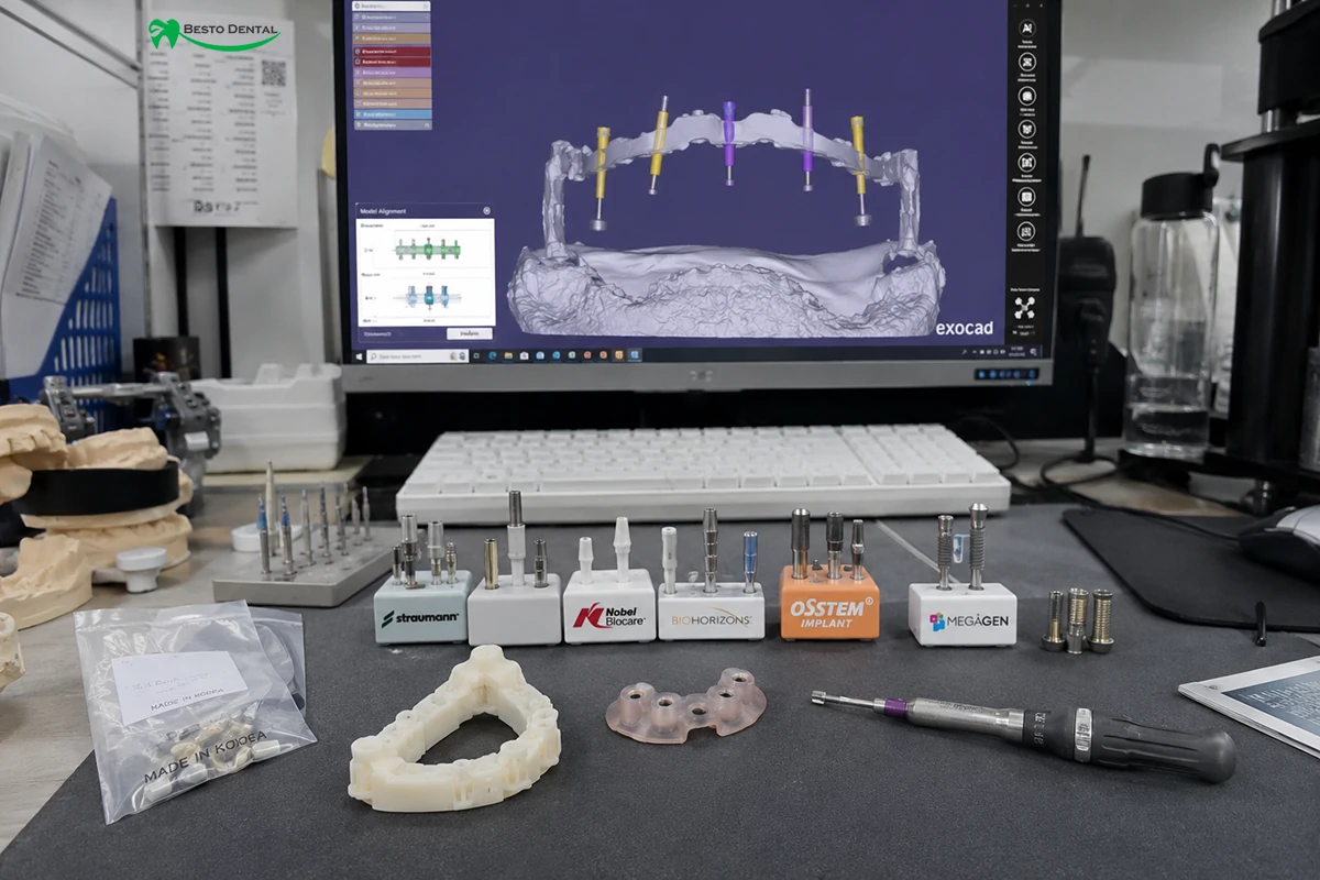 Implant-Supported Restorations
