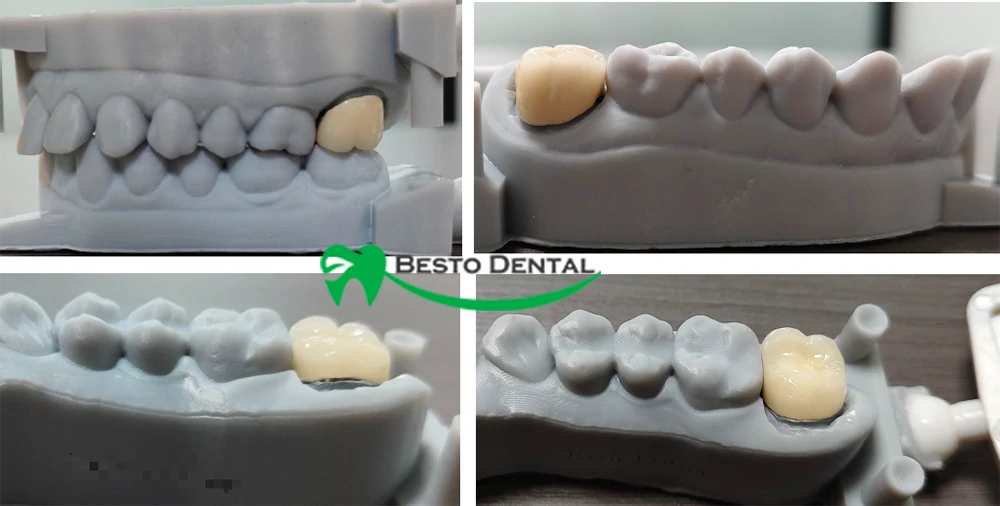 PFM study case