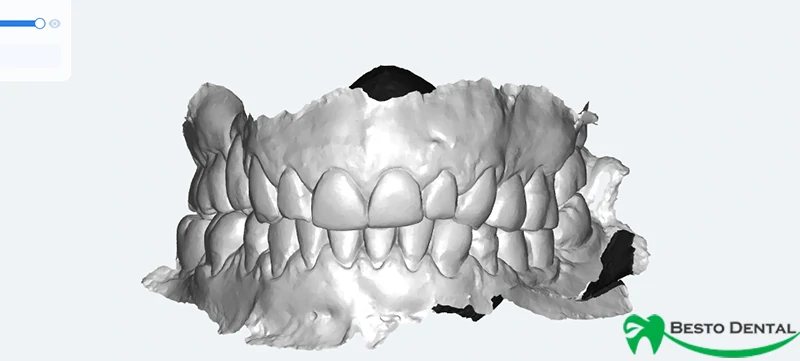Receiving the Model or Digital Scan