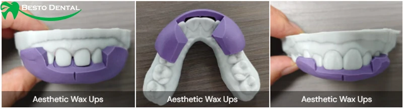 wax up