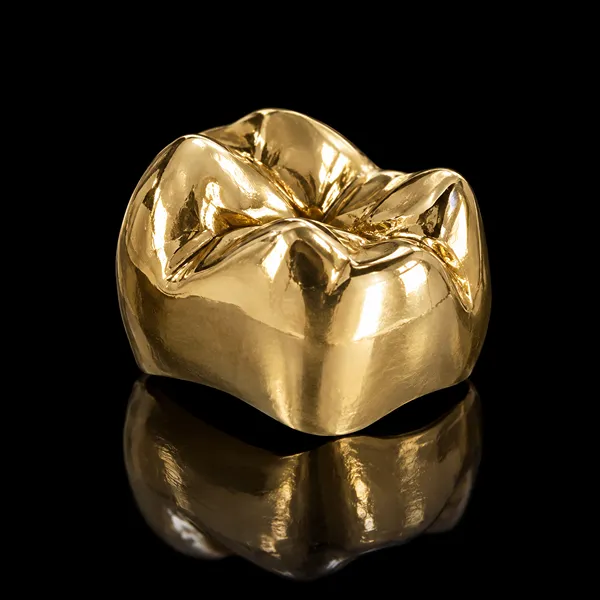 High Noble Metal Crown