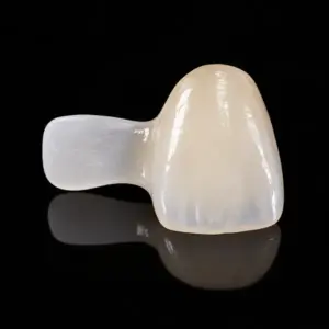 High-Translucency Anterior Zirconia Maryland Bridge