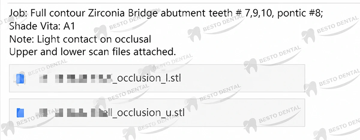 Manufacturing Process of Dental Bridges