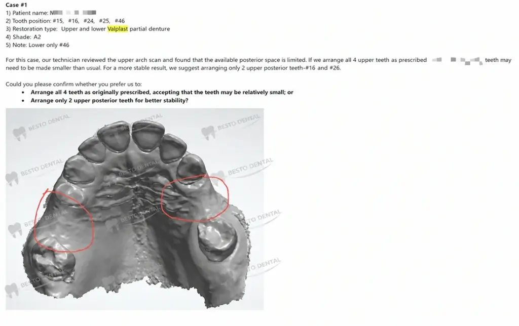 Materials of Flexible Dentures