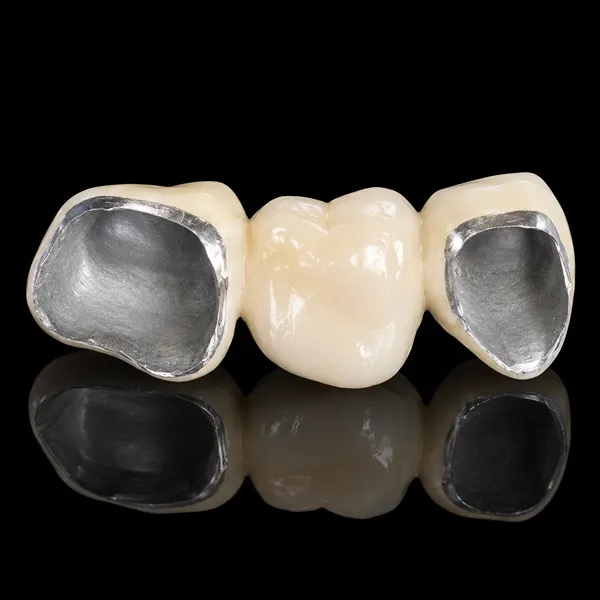 Ni-Cr PFM Crown