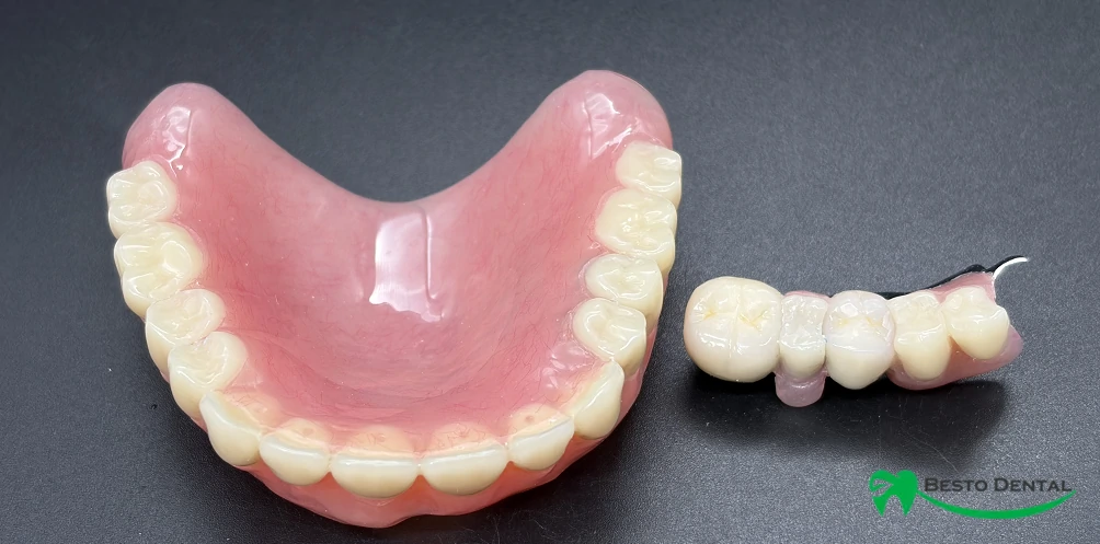 Precision Attachment Partial Dentures