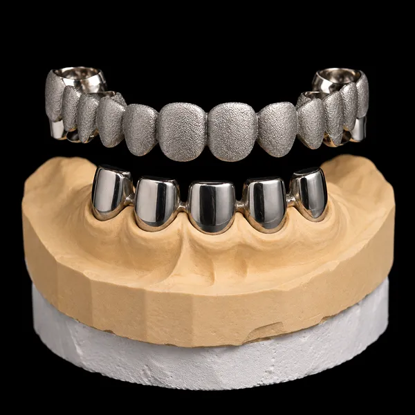 Secondary PFM Telescopic Crown