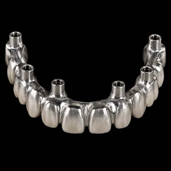 Titanium Full-Arch PFM Implant Bridge