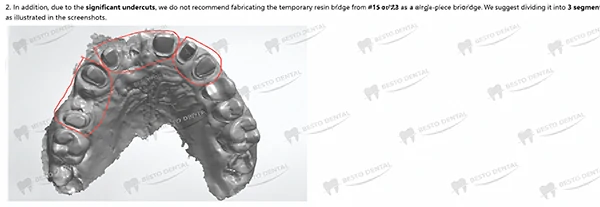 Zirconia Dental Bridge Fabrication Process