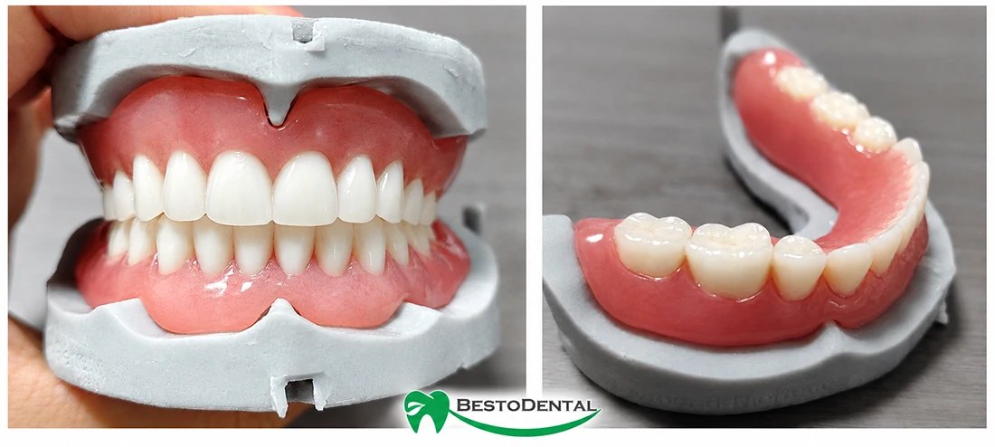 complete denture