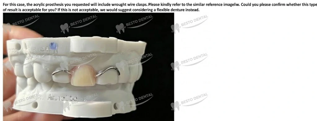 have the clasps visible