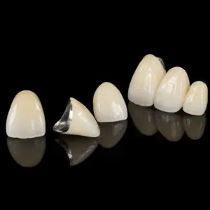 PFM Crown Anterior Teeth