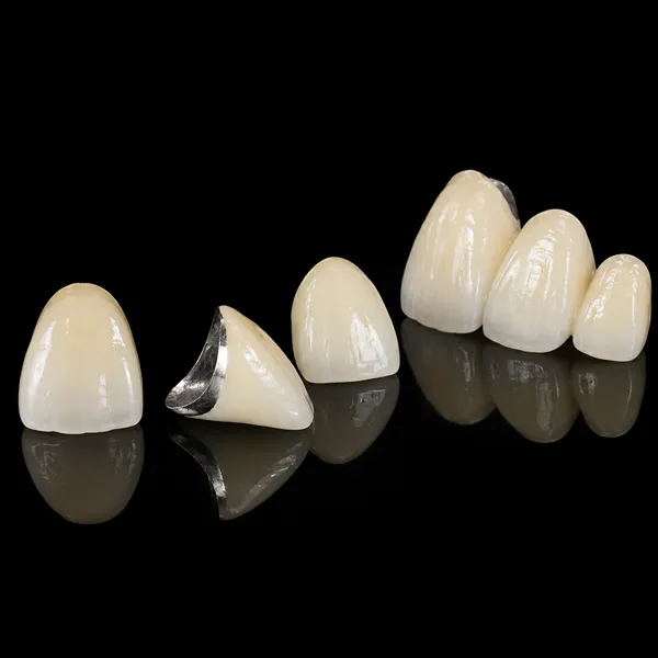 PFM Crown Anterior Teeth